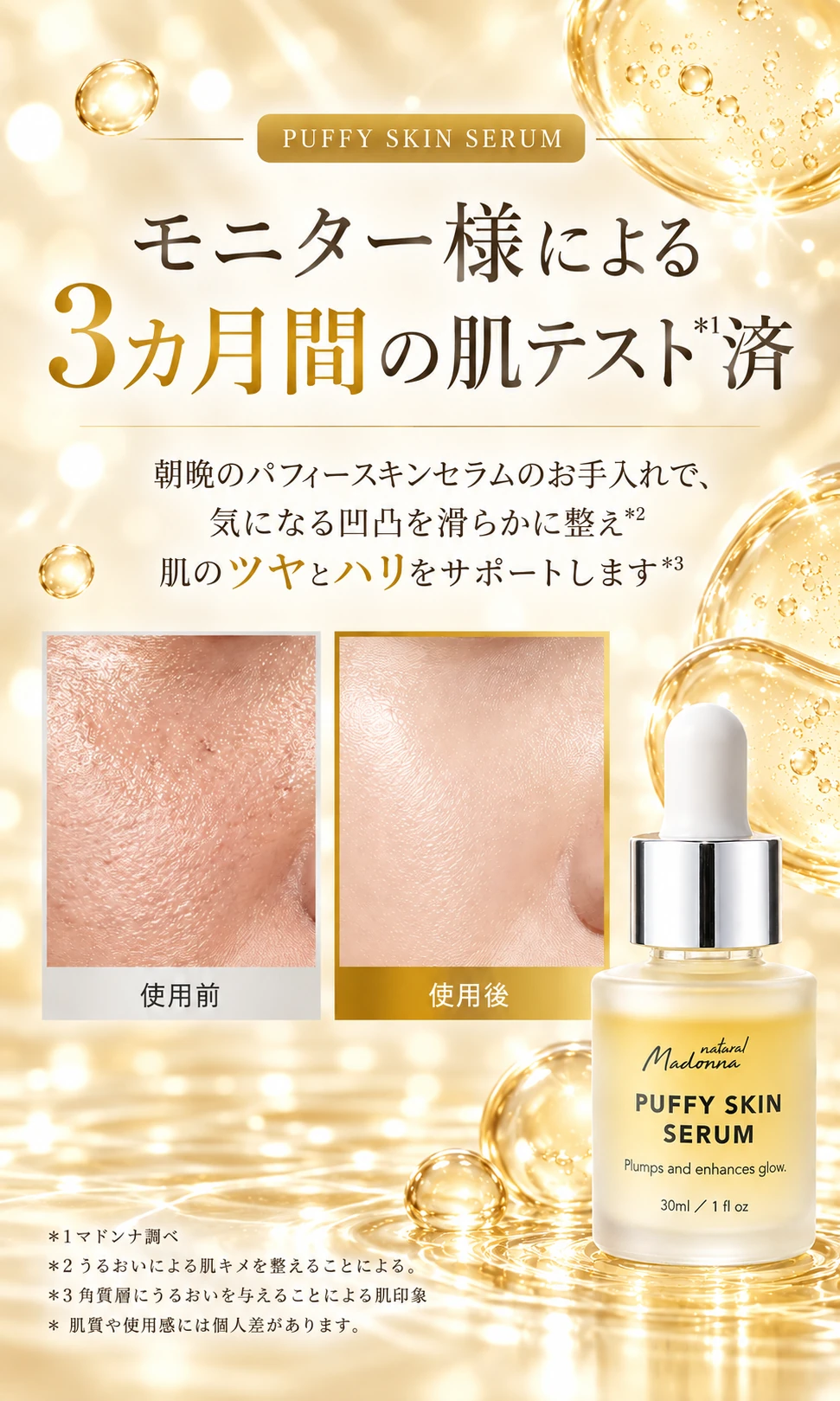 PUFFY SKIN SERUM モニター様による3カ月間の肌テスト＊1済 朝晩のパフィースキンセラムのお手入れで、気になる凹凸を滑らかに整え＊2 肌のツヤとハリをサポートします＊3 使用前 使用後 ＊1マドンナ調べ ＊2うるおいによる肌キメを整えることによる。＊3角質層にうるおいを与えることによる肌印象 ＊肌質や使用感には個人差があります。